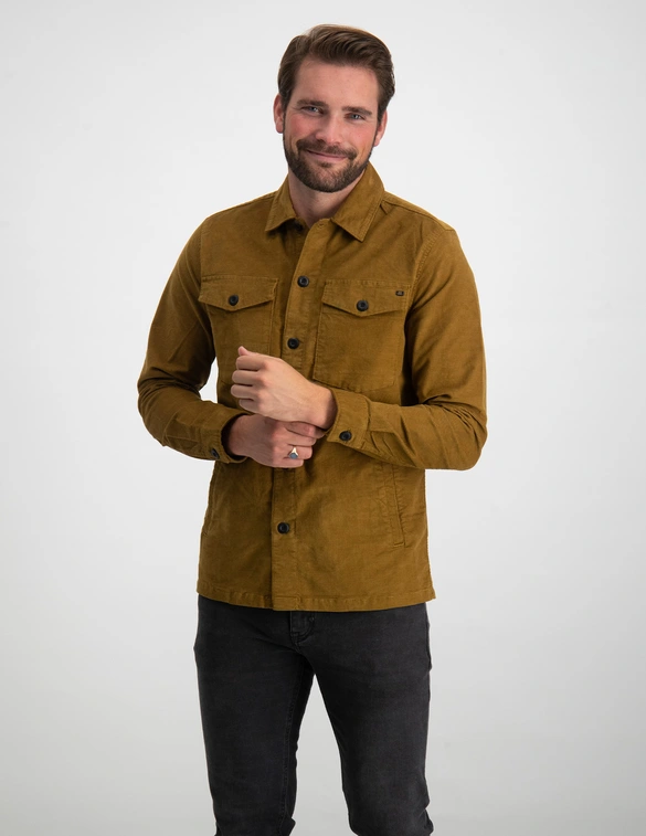 No Excess Overshirt Button Closure Structure 21530826