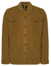 No Excess Overshirt Button Closure Structure 21530826